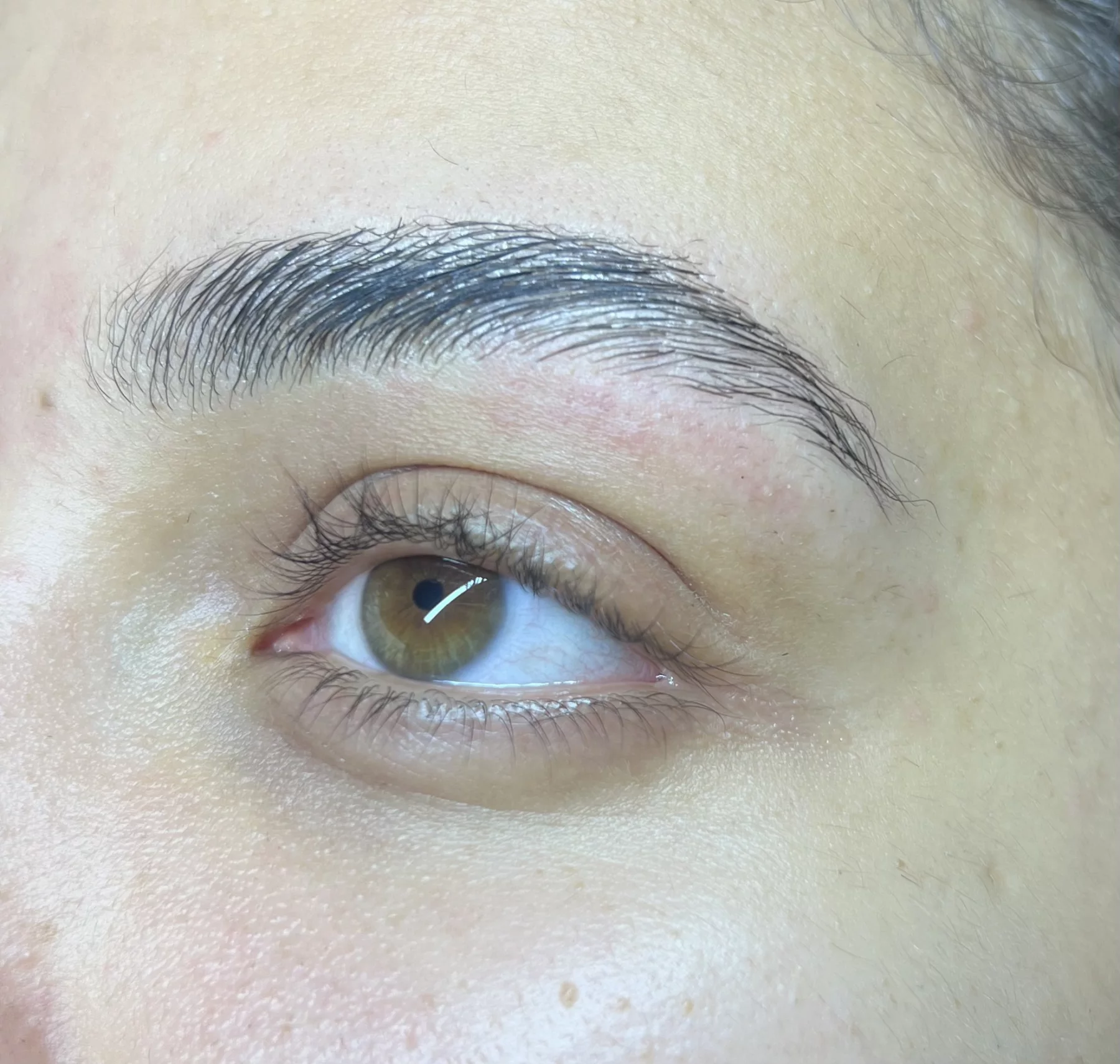 Brow Lift & Restructuration