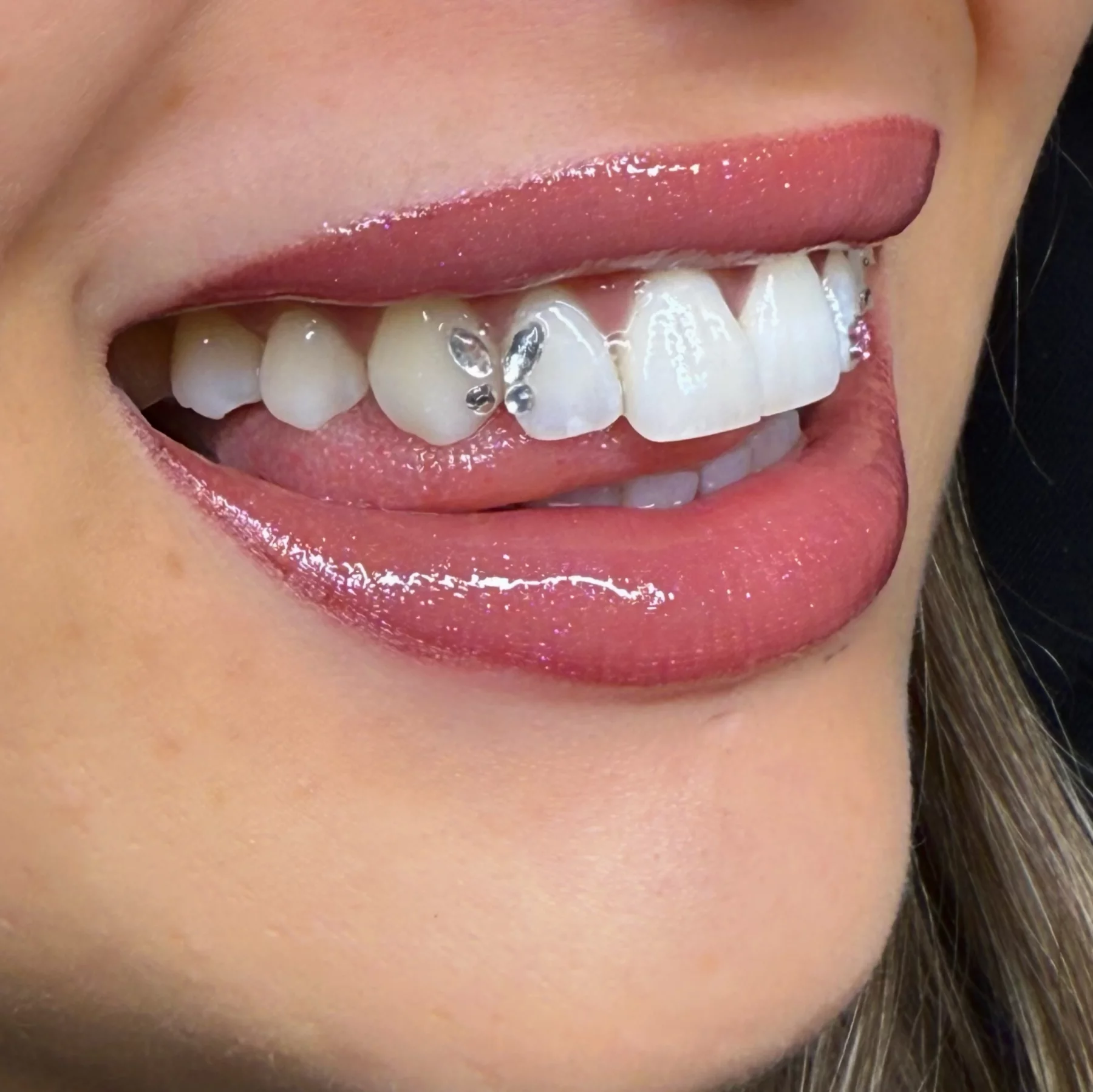 Strass Dentaire Haute Brillance